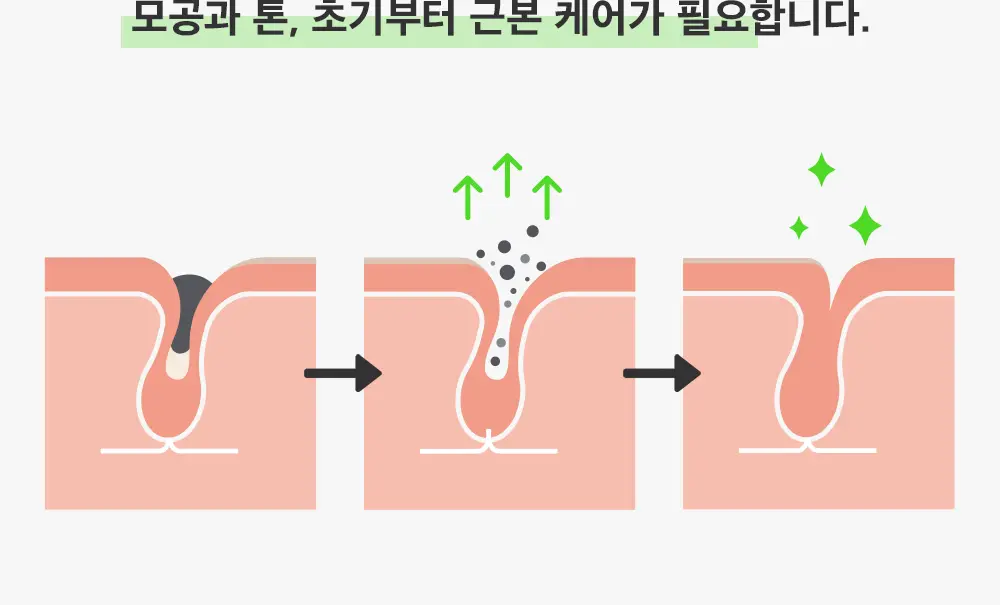 [모공컨트롤샷]폴라초이스 10% 나이아신아마이드 부스터 앰플 20ml 상세페이지 7